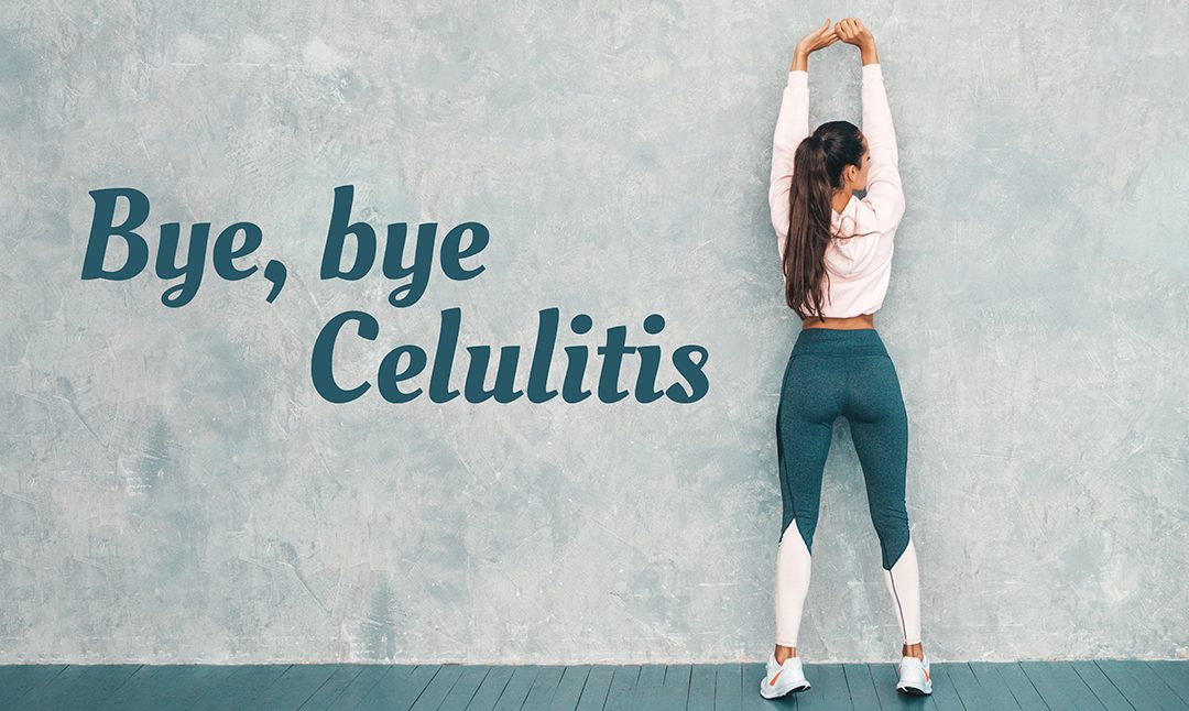 ¡Bye, bye celulitis! 5 consejos para combatirla