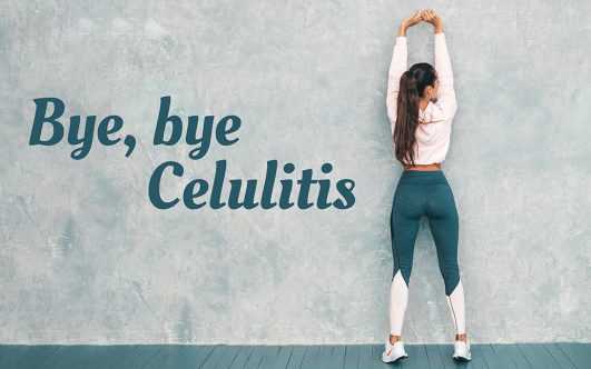 ¡Bye, bye celulitis! 5 consejos para combatirla