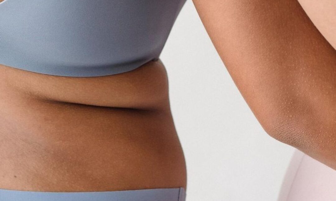 Crioterapia estética: el frío para abordar la grasa localizada